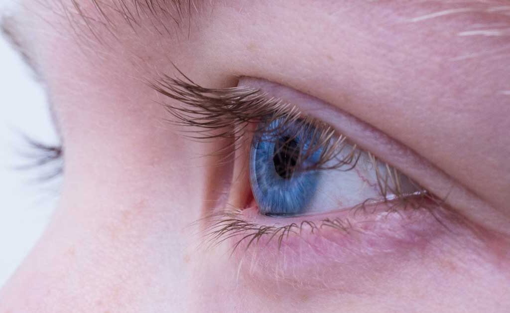 Augenlidstraffung mit Plasma Technologie